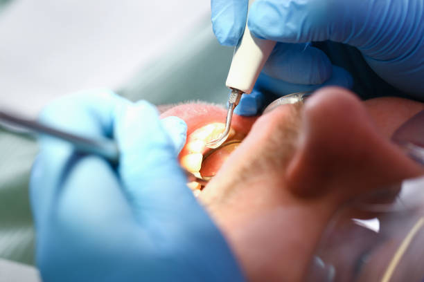 Best Orthodontic Emergency Dentist in Solana, FL