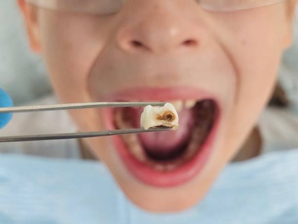 Best Urgent Dental Care for Toothache in Solana, FL